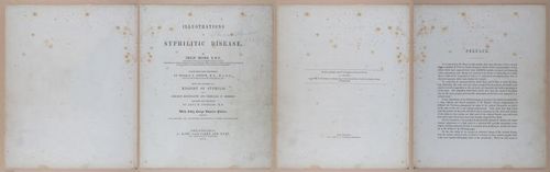 E345 - Illustrations of Syphilitic - i11784-11785-11789