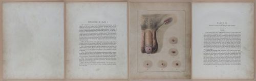 E345 - Illustrations of Syphilitic - i11859-11860-11861