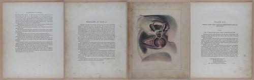 E345 - Illustrations of Syphilitic - i11862-11863-11864-11865
