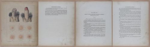 E345 - Illustrations of Syphilitic - i11870-11871-11872-11873