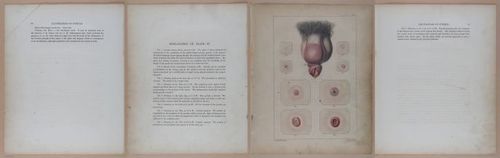 E345 - Illustrations of Syphilitic - i11874-11875-11876-11877