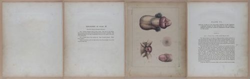 E345 - Illustrations of Syphilitic - i11882-11883-11884