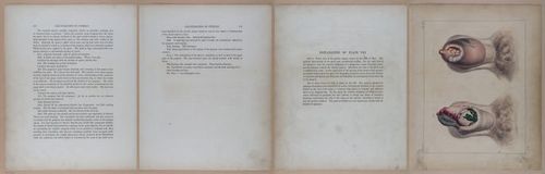 E345 - Illustrations of Syphilitic - i11900-11901-11902-11903