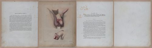 E345 - Illustrations of Syphilitic - i11926-11927-11928