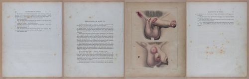 E345 - Illustrations of Syphilitic - i11933-11934-11935-11936