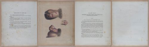 E345 - Illustrations of Syphilitic - i11941-11942-11944