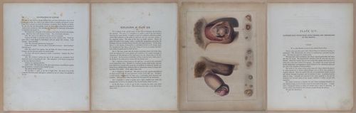 E345 - Illustrations of Syphilitic - i11949-11950-11951-11952