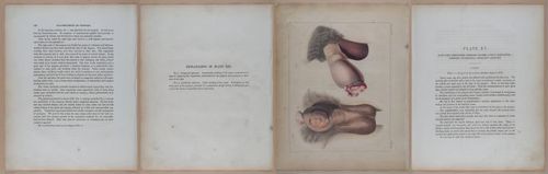 E345 - Illustrations of Syphilitic - i11953-11954-11955-11956