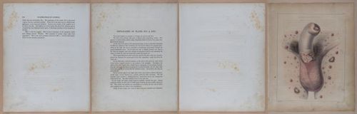 E345 - Illustrations of Syphilitic - i11973-11974-11975-11976