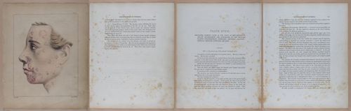 E345 - Illustrations of Syphilitic - i11977-11978-11979-11980