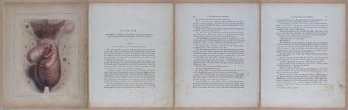 E345 - Illustrations of Syphilitic - i11985-11986-11987-11988