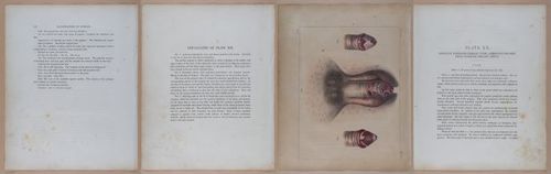 E345 - Illustrations of Syphilitic - i11989-11990-11991-11992