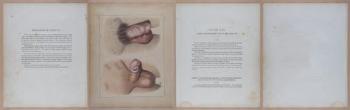 E345 - Illustrations of Syphilitic - i11997-11998-11999