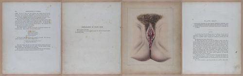 E345 - Illustrations of Syphilitic - i12012-12013-12014-12015