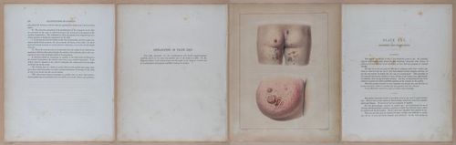 E345 - Illustrations of Syphilitic - i12020-12021-12022-12023