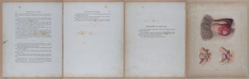 E345 - Illustrations of Syphilitic - i12024-12025-12026-12027