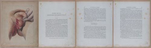 E345 - Illustrations of Syphilitic - i12033-12034-12035-12036