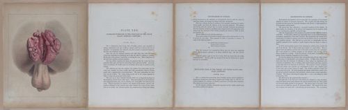 E345 - Illustrations of Syphilitic - i12049-12050-12051-12052