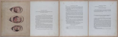 E345 - Illustrations of Syphilitic - i12057-12058-12059-12061