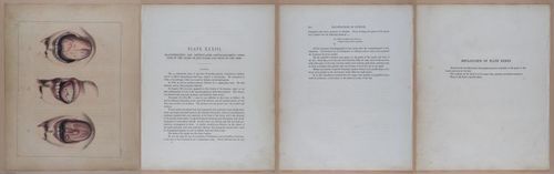 E345 - Illustrations of Syphilitic - i12073-12074-12075-12076