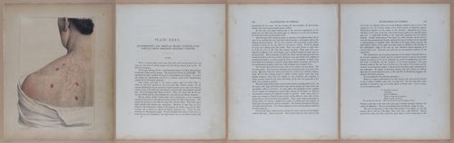 E345 - Illustrations of Syphilitic - i12081-12082-12083-12084