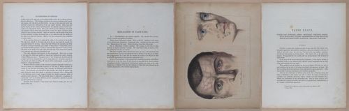 E345 - Illustrations of Syphilitic - i12086-12087-12088-12089