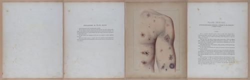 E345 - Illustrations of Syphilitic - i12098-12099-12100