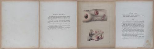 E345 - Illustrations of Syphilitic - i12116-12117-12119