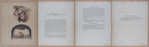 E345 - Illustrations of Syphilitic - i12124-12125-12126-12127