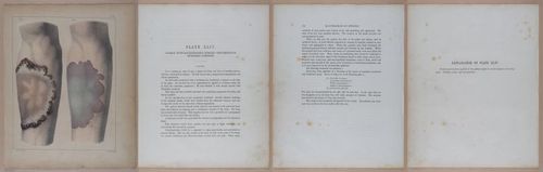 E345 - Illustrations of Syphilitic - i12128-12129-12130-12131