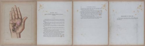 E345 - Illustrations of Syphilitic - i12132-12133-12134-12135