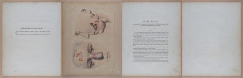 E345 - Illustrations of Syphilitic - i12146-12147-12148