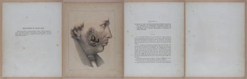 E345 - Illustrations of Syphilitic - i12157-12158-12159