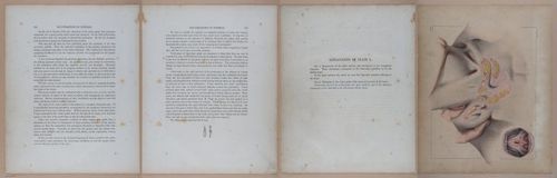 E345 - Illustrations of Syphilitic - i12164-12165-12166-12167