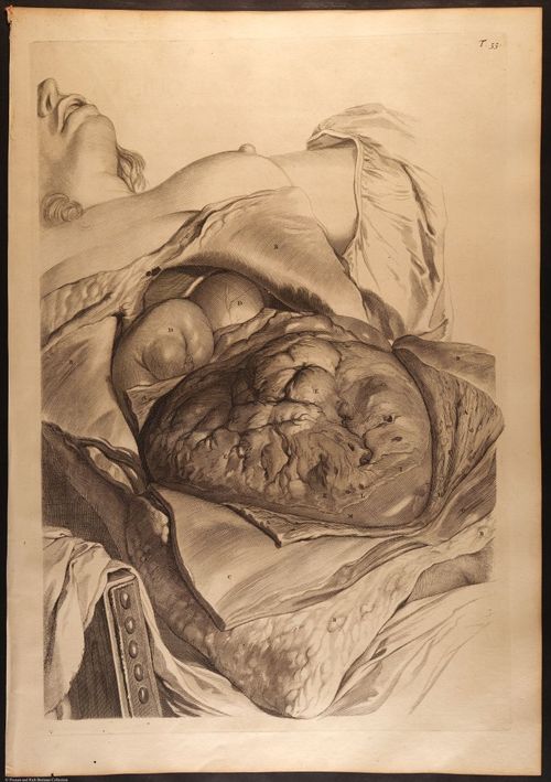 E466 - Anatomy Atlas - Cowper - i0622