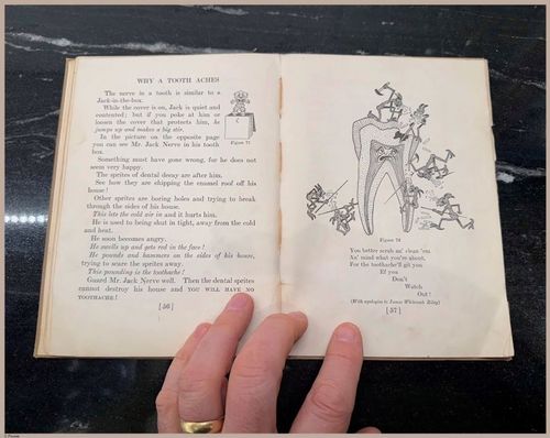 E475 - Teeth - i0041