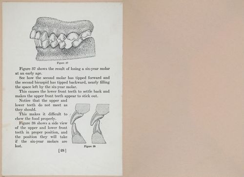 E475 - Teeth - i22566