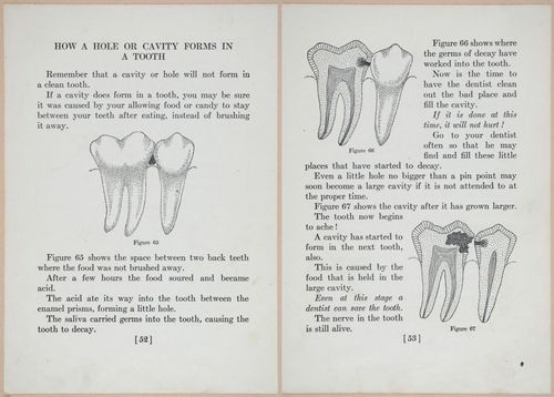 E475 - Teeth - i22589-22590