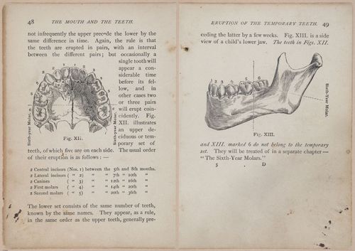 E525 - Teeth - i25112-25113