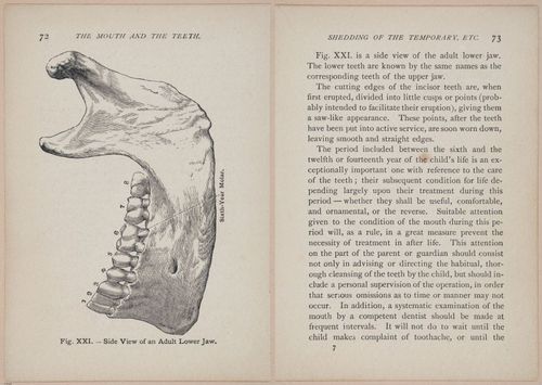 E525 - Teeth - i25136-25137