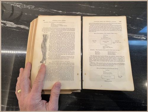 E675 - A System of Human Anatomy - 1857 - 2704