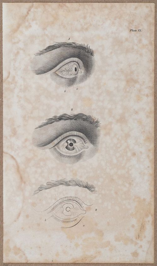 E696 - First Line of Surgery - i10016