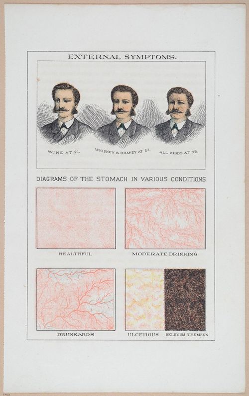 Diagrams of a Face and the Stomach
